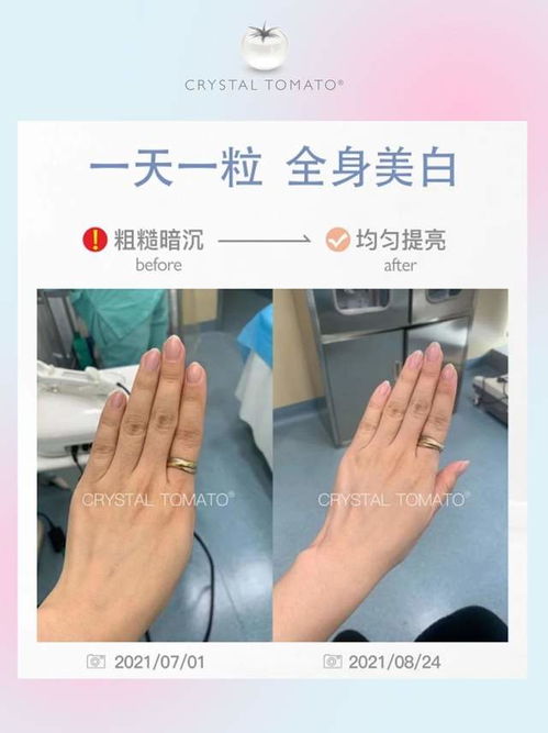怎样美白才有用 美白成分党看过来